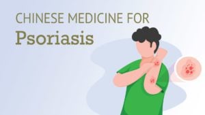 Chinese Medicine for Psoriasis | Best Chinese Medicines