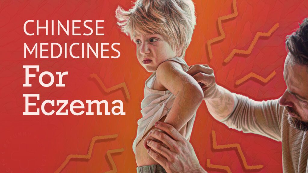 Chinese Medicines for Eczema Best Chinese Medicines